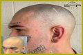 Unveiling The Truth: Steve Austin's Baldness Decoded